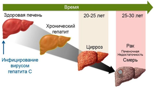 Хронический гепатит. Внепеченочные признаки, симптомы, патогенез, осложнения