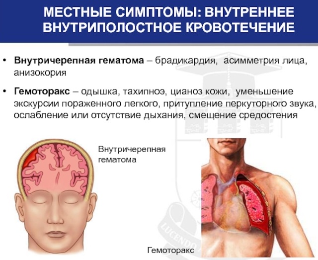 Кровотечение: понятие и виды, причины, первая помощь, способы остановки, лечение