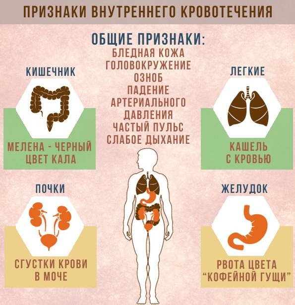 Кровотечение: понятие и виды, причины, первая помощь, способы остановки, лечение