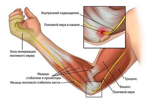 Немеют мизинцы на обеих руках. Причины, от чего во время сна, лечение