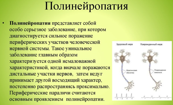 Немеют мизинцы на обеих руках. Причины, от чего во время сна, лечение