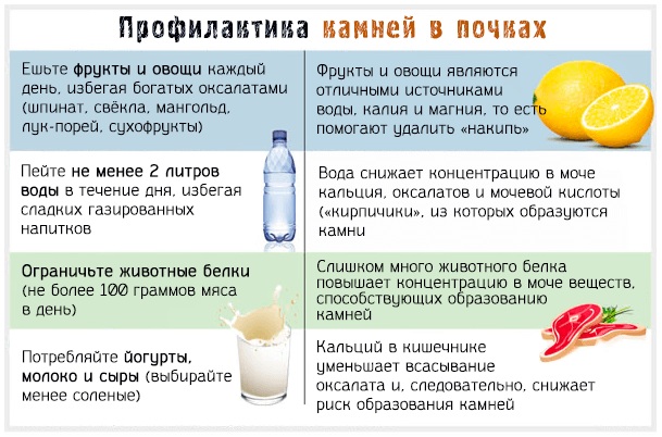 Оксалаты в моче. Причины у женщин, что это значит, лечение, диета, при беременности