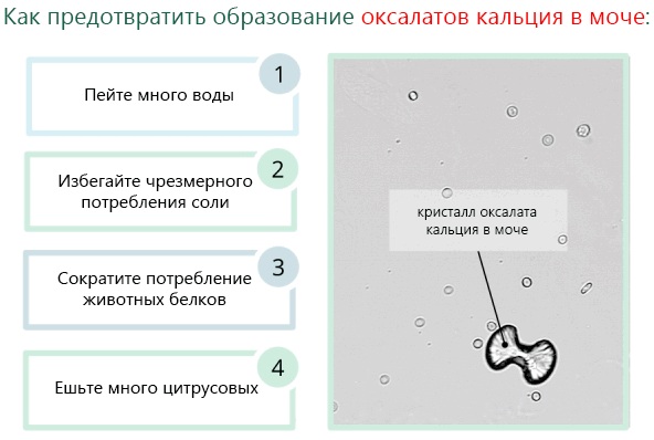 Оксалаты в моче. Причины у женщин, что это значит, лечение, диета, при беременности