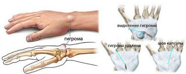 Онемение рук у женщин. Причины ночью, днем, лечение