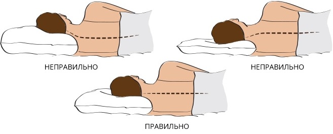 Онемение рук у женщин. Причины ночью, днем, лечение