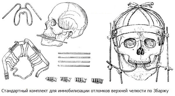 Перелом верхней челюсти. Лечение, первая помощь, симптомы, открытый, закрытый