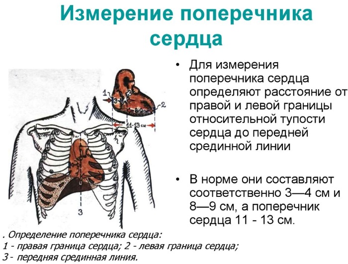 Поперечник сердца у детей. Норма, чему равен при недостаточности аортального клапана, гипертрофии желудочка, стенозе