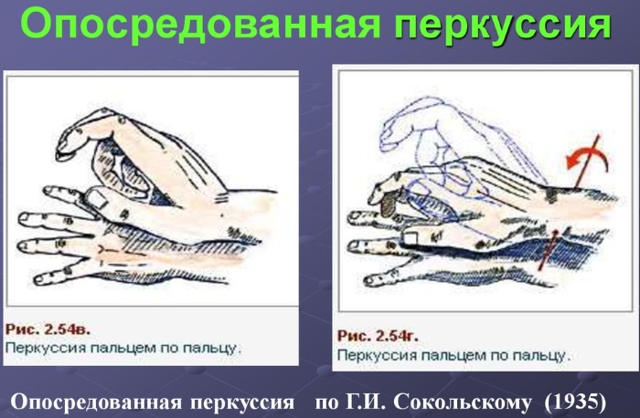 Поперечник сердца у детей. Норма, чему равен при недостаточности аортального клапана, гипертрофии желудочка, стенозе