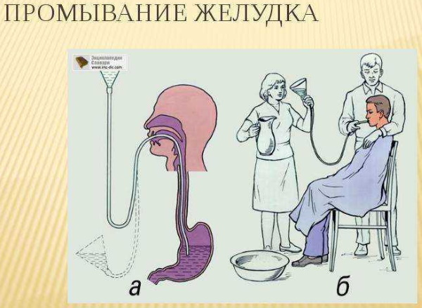 Отравление уксусом. Симптомы, первая помощь, рекомендации