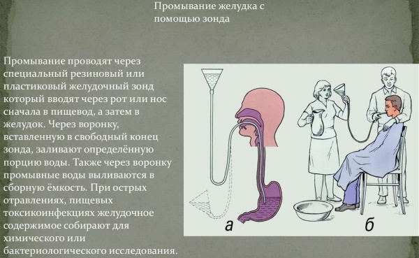 Промывание желудка через зонд у детей, взрослых. Алгоритм, техника, противопоказания