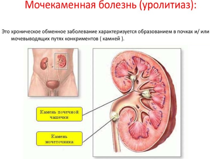 Роватинекс (Rowatinex). Аналоги и заменители, инструкция по применению, цена