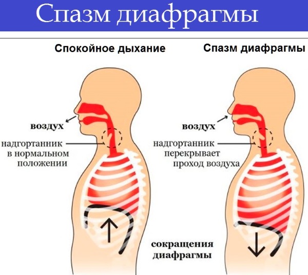 Тяжесть в правом боку под ребрами. Причины после еды, алкоголя, лечение