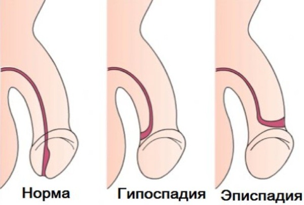 Уретра у женщин, мужчин. Что это такое, анатомия, где находится, функции, заболевания