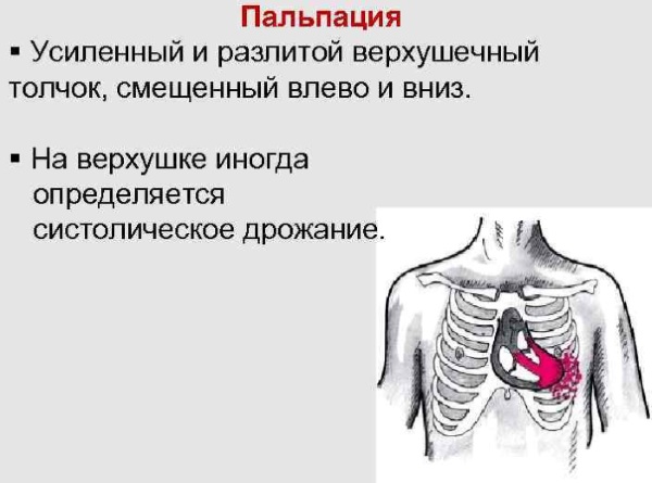 Верхушечный толчок. Норма у детей, при гипертонической болезни, гипертрофии желудочка, ИБС