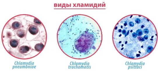 Фронтит и гайморит: разница, если одновременно, лечение