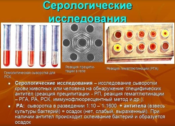 Анализы на бактериальные инфекции кишечника, гинекологии, у мужчин, детей, женщин