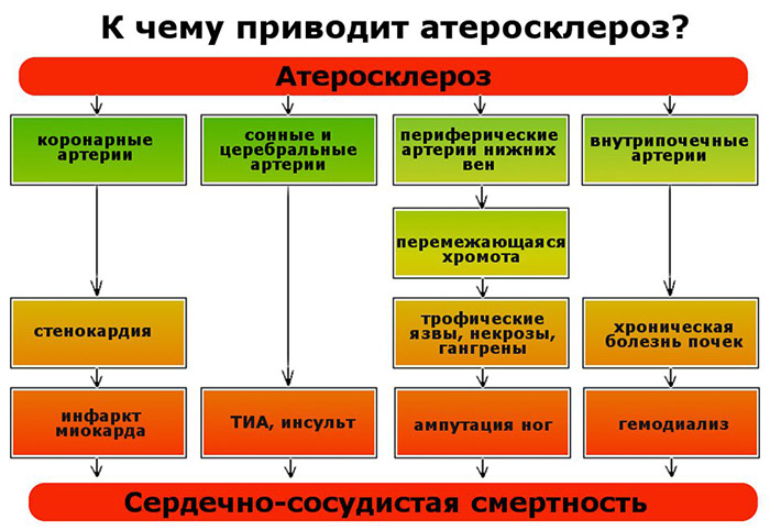 Атеросклероз сосудов сердца. Симптомы и лечение у пожилых людей, причины