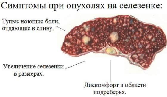 Боль в селезенке. Симптомы при ходьбе, беге, вдохе. Причины и лечение