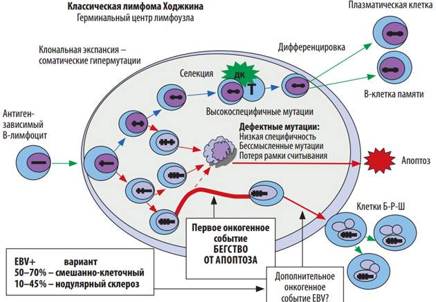 Уровская болезнь картинки