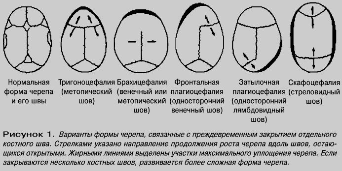 Возникают картинки в голове