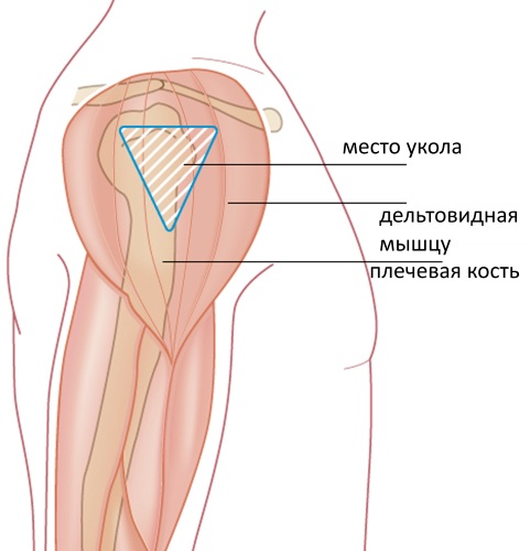 Как делать уколы в бедро правильно внутримышечно, самому себе, куда колоть. Фото, видео