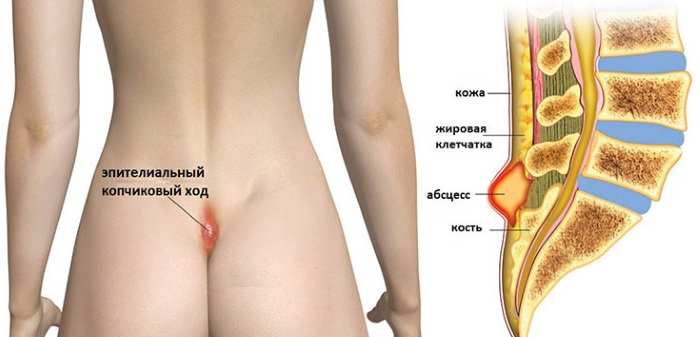 Копчик у человека. Анатомия, где находится, функции, как и почему болит