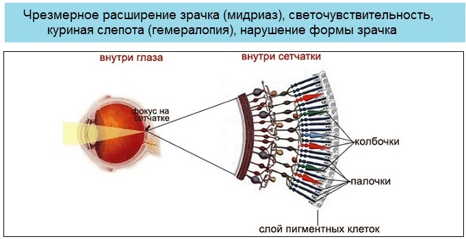 Куриная слепота. Когда возникает, недостаток витаминов, симптомы, причины, лечение