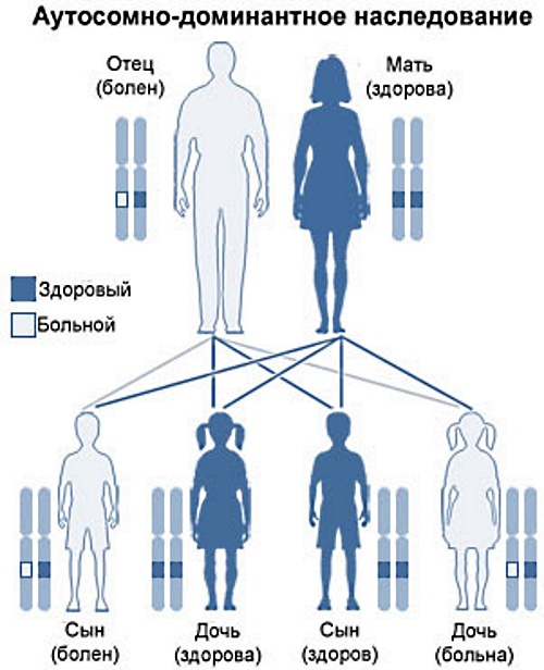 Наследственные заболевания схема