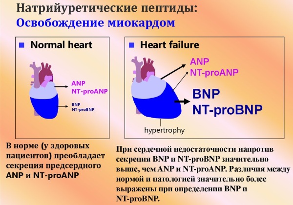 Натрийуретический пептид при сердечной недостаточности. Норма, как сдавать анализ, лечение