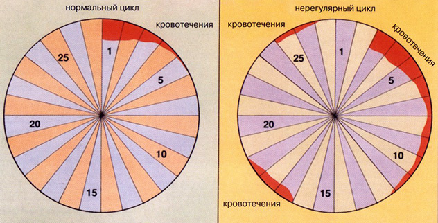 Не регулярный менструационный цикл. Причины у подростков, после родов, как лечить, забеременеть