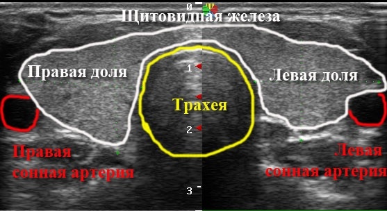 Не регулярный менструационный цикл. Причины у подростков, после родов, как лечить, забеременеть