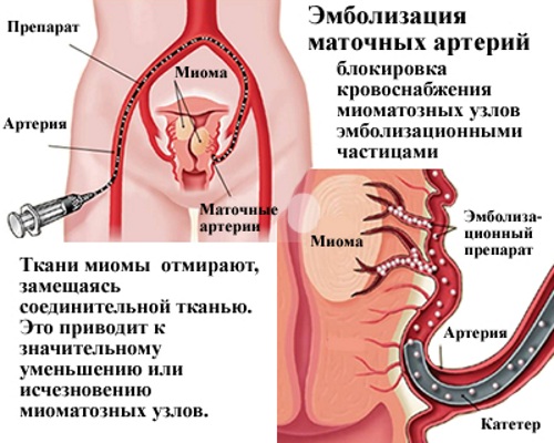 Не регулярный менструационный цикл. Причины у подростков, после родов, как лечить, забеременеть