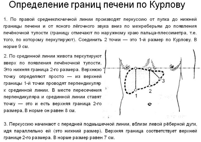 Пальпация печени фото