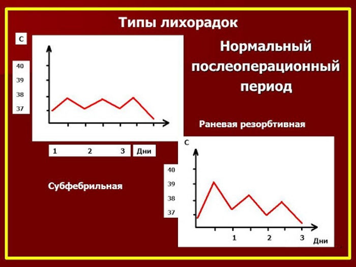 Послеоперационные осложнения в хирургии. Что это такое, ранние, поздние, классификация