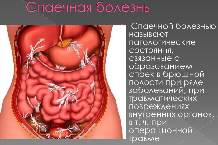 Послеоперационные осложнения в хирургии. Что это такое, ранние, поздние, классификация