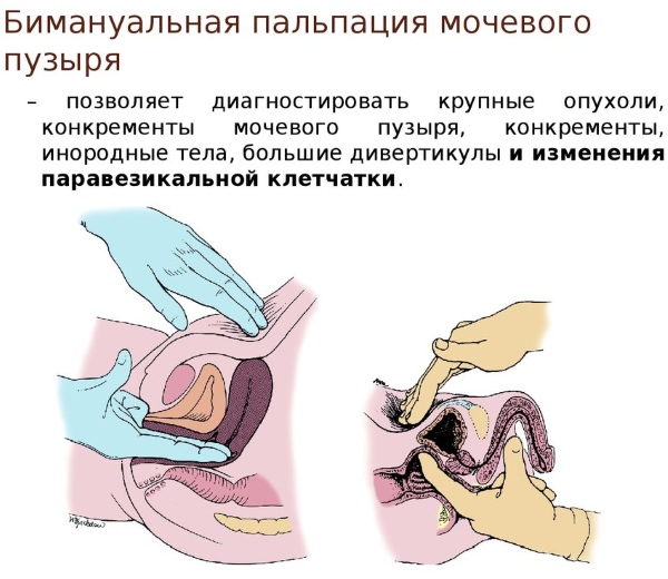 Поверхностная пальпация живота. Алгоритм, что определяет у детей, взрослых