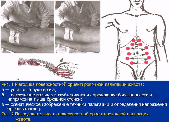 Терминальный илеит что это такое. Клинические рекомендации