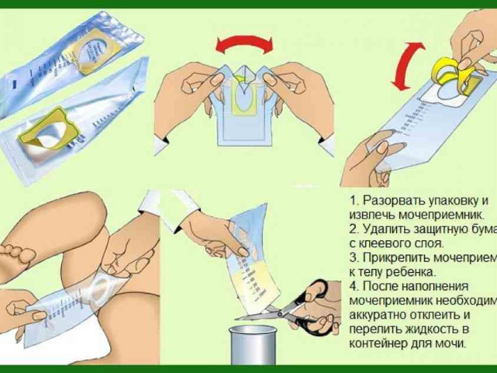 Проба Сулковича у детей, взрослых. Что это такое, как собирать, расшифровка