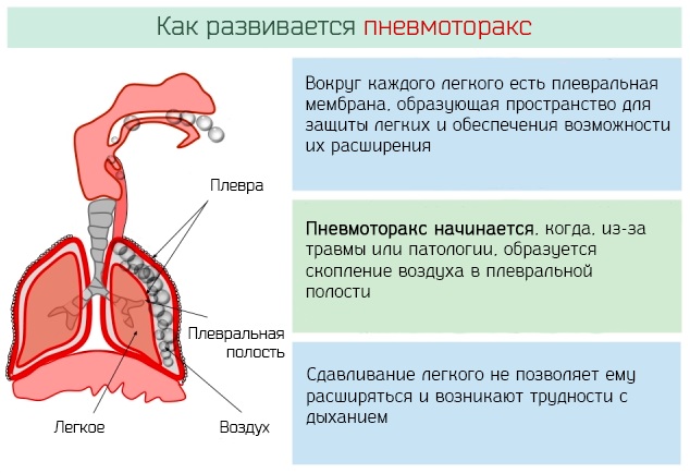 Сердечно-легочная реанимация. Что это такое, показания, алгоритм проведения, клинические рекомендации