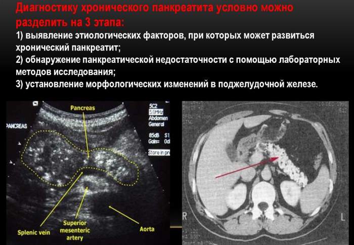 Температура при панкреатите у взрослых, детей. Причины, что делать