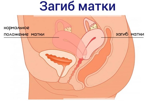 Тяжесть в желудке. Причины и лечение, что принять после еды, перед месячными, сном