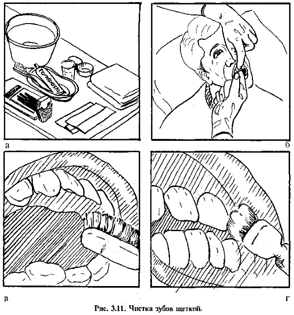 Уход за полостью рта тяжелобольного. Алгоритм, манипуляции, памятка кратко