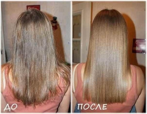 Волосы выпадают пучками у женщины. Причины, что делать, лечение