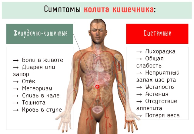 Болезни кишечника у мужчин. Симптомы, признаки