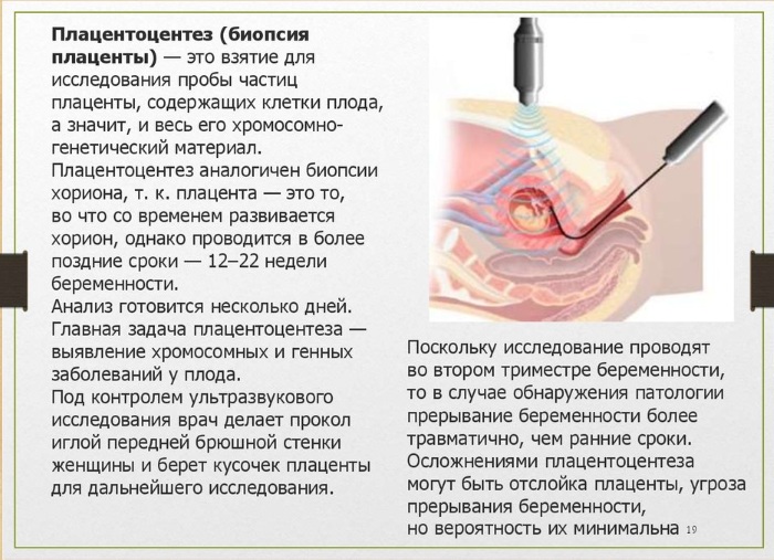 Генетический анализ крови ребенку, новорожденных. Что это, зачем, цена