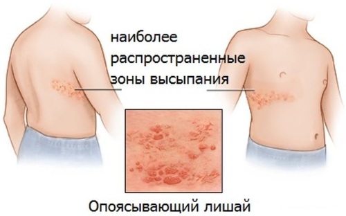 Аппликатор Кузнецова для шеи, спины. Отзывы, как применять, цена