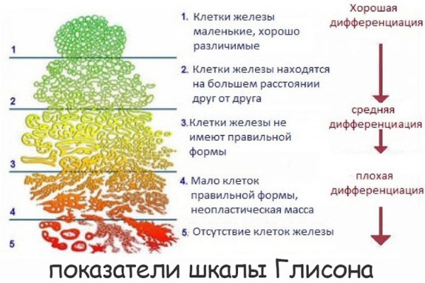 Биопсия. Что это за анализ простаты, хориона, шейки матки, эндометрия. Чем отличается от гистологии