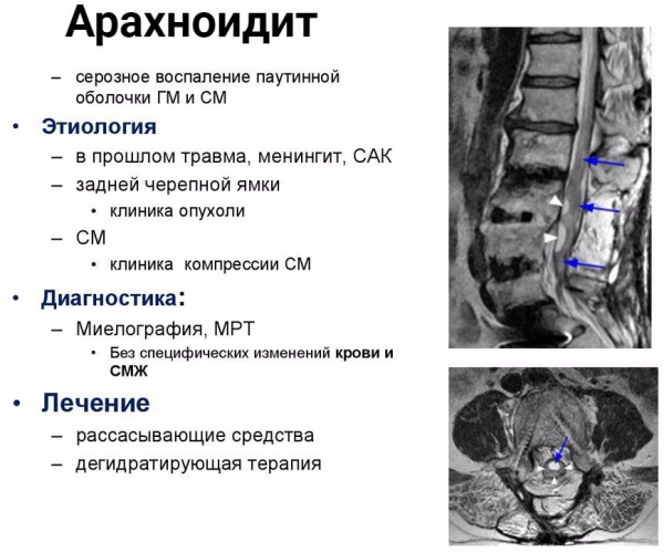 Болит затылочная часть головы. Причины и лечение, что делать