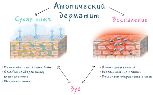 Атопик (Atopic) крем успокаивающий. Инструкция по применению для детей, отзывы