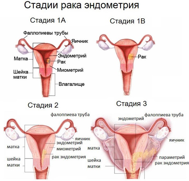 Десквамация эндометрия. Что это такое, в какие дни происходит, вследствие чего